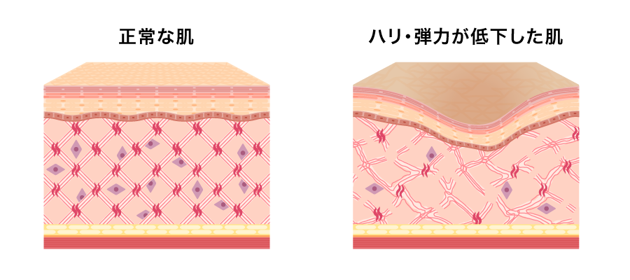 肌のキメを整えるには毎日のスキンケアが重要！化粧水や乳液で乾燥を防ごうHAPPINESS! magazine ハピネスマガジン