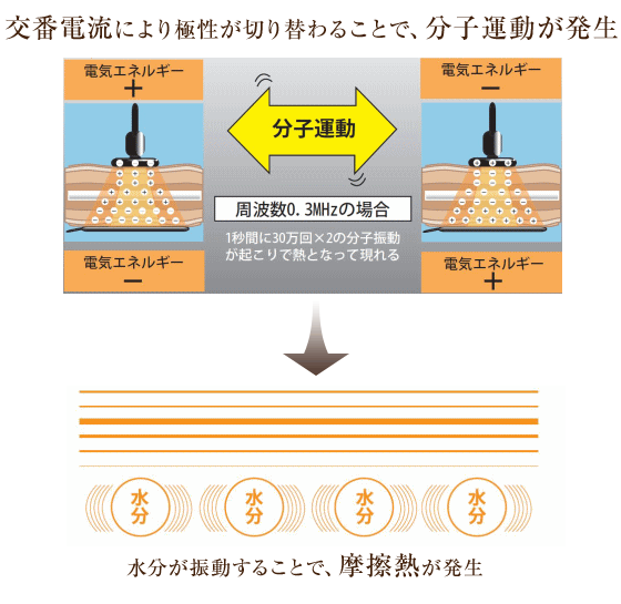 サーモシェイプの周波数が高いのはなぜ？効果は他と違うの？徹底解説