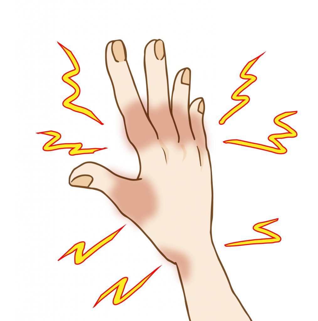 乾癬の種類乾癬パートナーズ