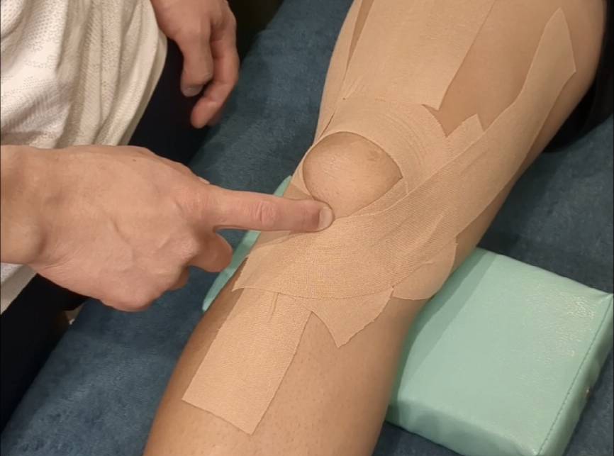 膝の慢性的な痛みに対するテーピング - CramerJapan