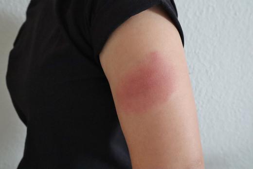 インフルエンザワクチン接種に関しての注意点たけしファミリークリニック北習志野・習志野台の内科・小児科・皮膚科・アレルギー科