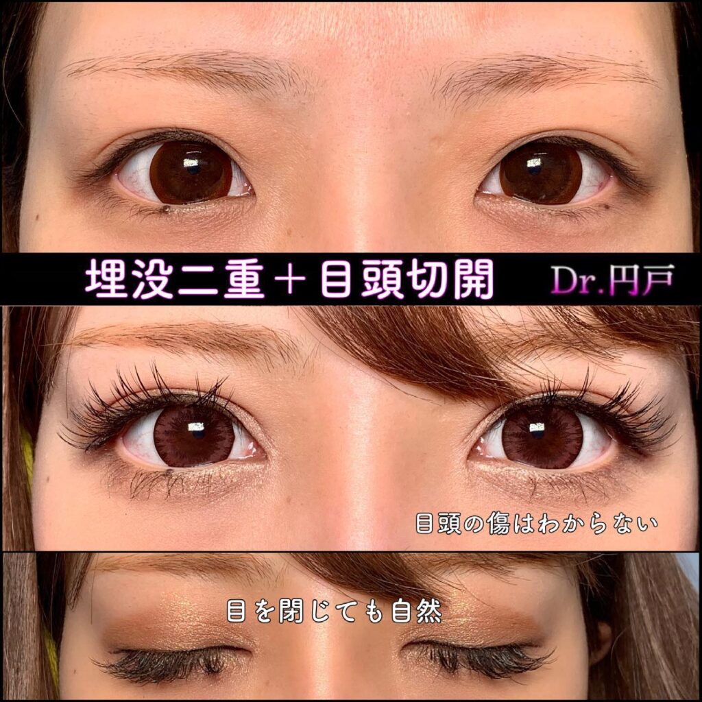 細いアーモンドアイ 目TikTok