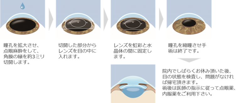 瞳孔記録計NPi-200日本医科大学付属病院 高度救命救急センター 横堀 將司 先生アイ・エム・アイ株式会社 IMI.Co.,Ltd