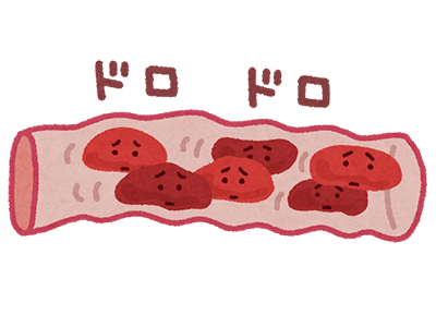 薬樹 管理栄養士 » Blog Archive » Vol.4 脂質異常症と食事