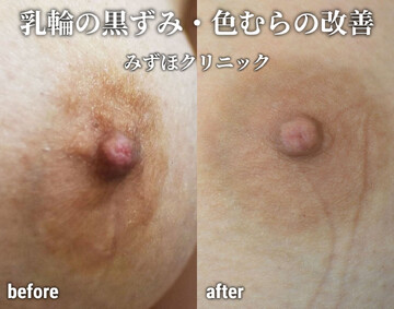 200GANA-2320】 池袋で見つけた若さ抜群のモチモチ巨乳ムスメ♪嫌がりながらもおっぱいをモミモミされて乳首はビンビン♪白くて柔らかいマシュマロおっぱい揺らして電マでガチイキ♪抵抗してたのに何度もイッてSEXを愉しむ♪  – パンツウォーカー