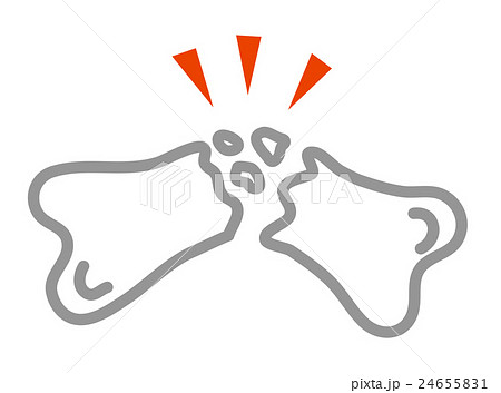 シンプルな骨折のイラスト289747168 毎月1点無料 フリー のストックフォト イメージマート