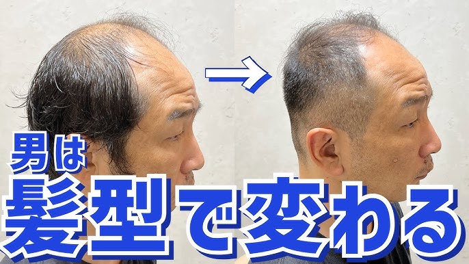 美容師監修 薄毛のメンズにおすすめの髪型15選！スタイリングのコツも伝授 - OZmall