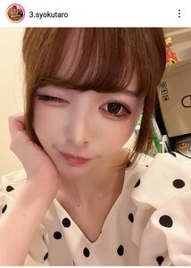 I will tell you everything about the cosmetic surgery I have hadSurveillance revealed- YouTube