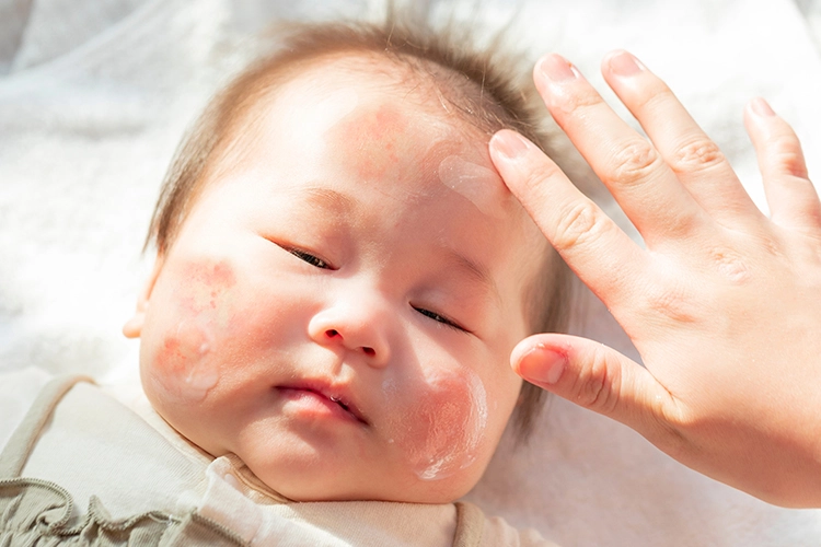 生後1ヶ月、首のポツポツが消えました。お薬を手放したいママのためのおうちで簡単予防ケア 千葉志織