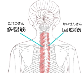 多裂筋のトリガーポイントトリガーポイント・ネットトリガーポイント注射で痛みを解消ビタカイン製薬