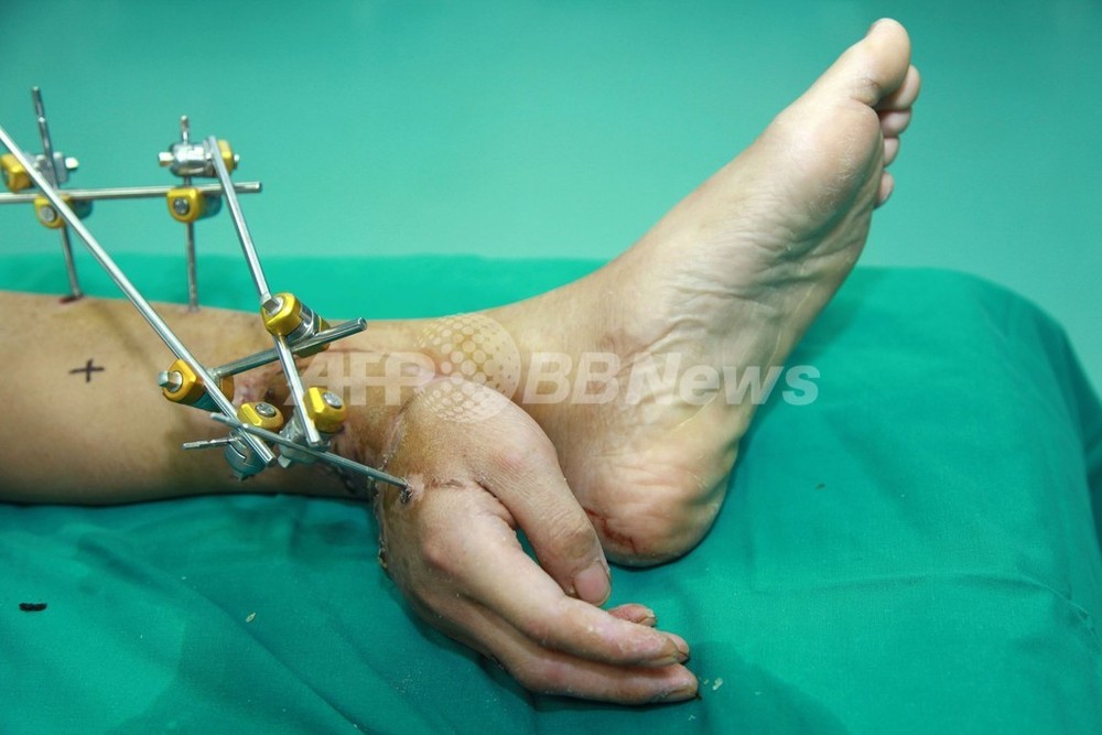 とても大切な「手」の外科治療病気と治療の検索サイト「メディカルブレイン」