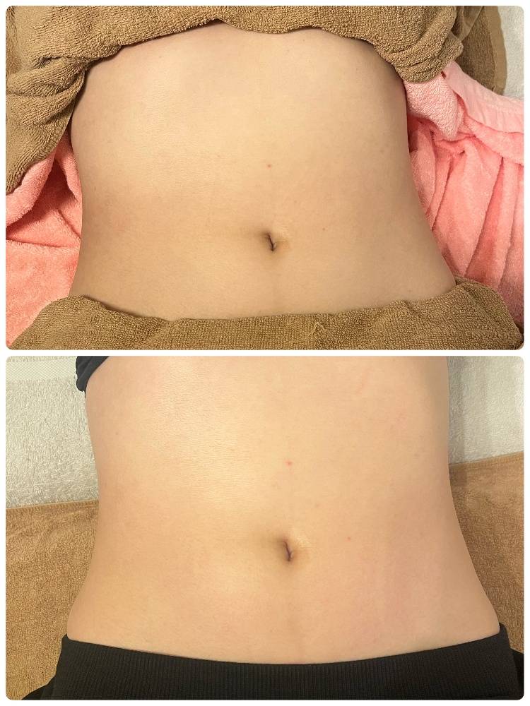 続編！便秘解消・ダイエット・免疫力アップ簡単リンパマッサージ♡宮城県リンパマッサージ＆フェイシャル 岩盤浴マットで温活 リンパ&デトックスサロンルクオーレ