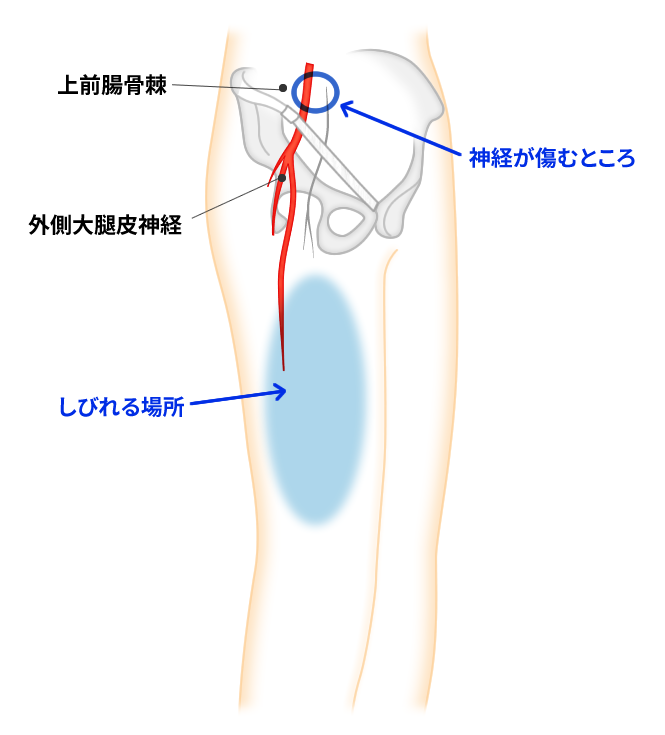 腰の健康を研究する専門家が開発した「さかいキューブ」
