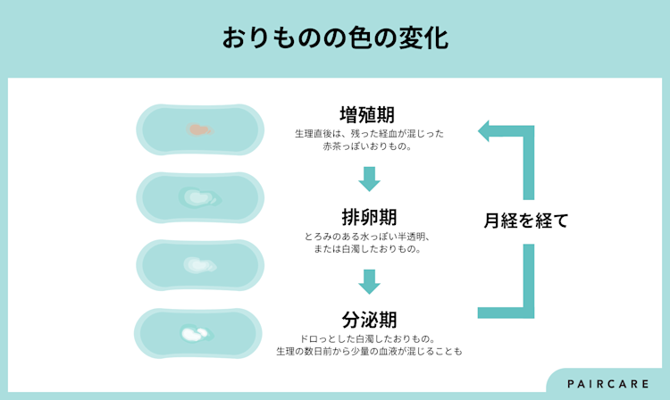 おりものの異常について横浜市の産婦人科「Sola Clinic」
