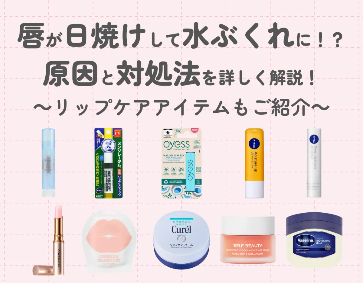 唇が日焼けした時の症状とは? 正しいケア方法や予防対策について解説 - SillHa.com - 歯と口と身体の健康メディア -シルハドットコム- SillHa.com - 歯と口と身体の健康メディア -シルハドットコム