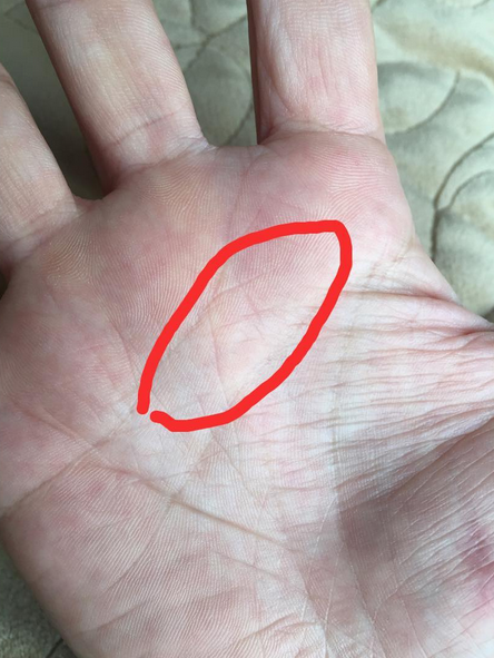 ラッキーな手相５ 薬指の下の太陽丘・太陽線にスター 星紋 がある手相