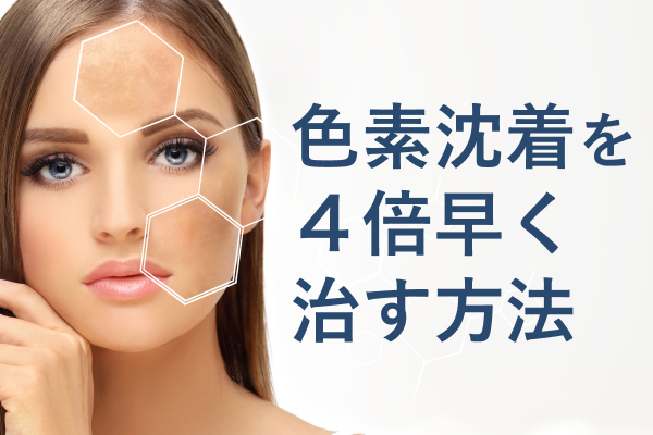 炎症後色素沈着を治すには？シミやニキビ跡と何が違うの？美容皮膚科の町田マリアクリニック