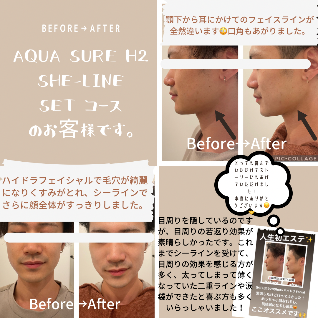 男性歓迎東京都でオススメ 美白エステが得意なエステサロン30選楽天ビューティ