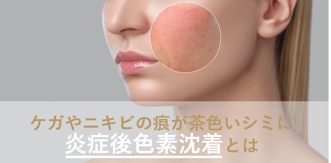 シミ・色素沈着の除去美容外科・美容皮膚科・形成外科 共立美容外科仙台院