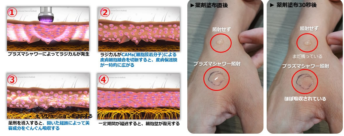 肌の再生医療フォーシーズンズ美容皮膚科クリニック東京院東京・銀座