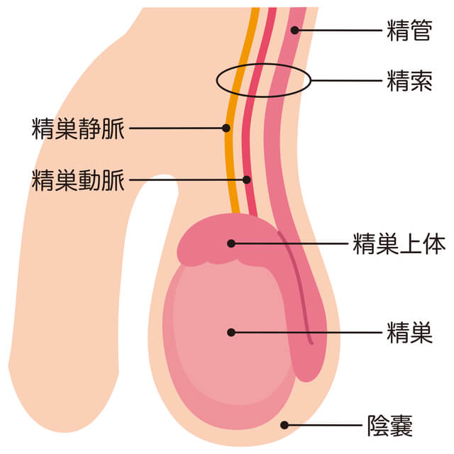 精索静脈瘤とは男性不妊・メンズヘルス診療 プライベートケアクリニック東京
