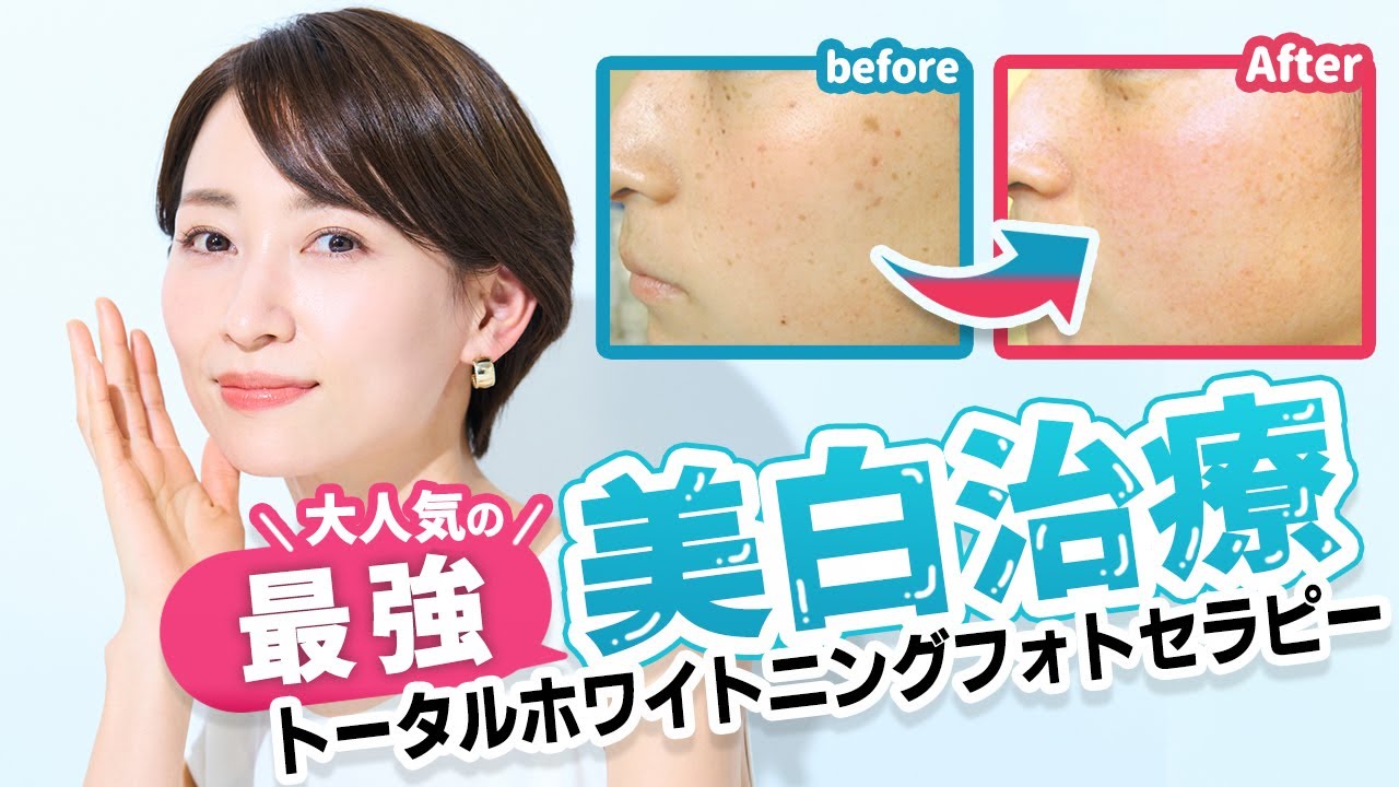 美肌・美白治療 - 銀座・名古屋・心斎橋の美肌治療は椿クリニック