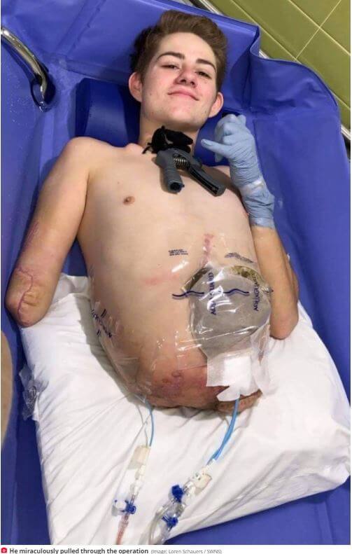 労災で指や腕、足 脚 切断の場合の慰謝料の計算労働災害SOSみらい総合法律事務所