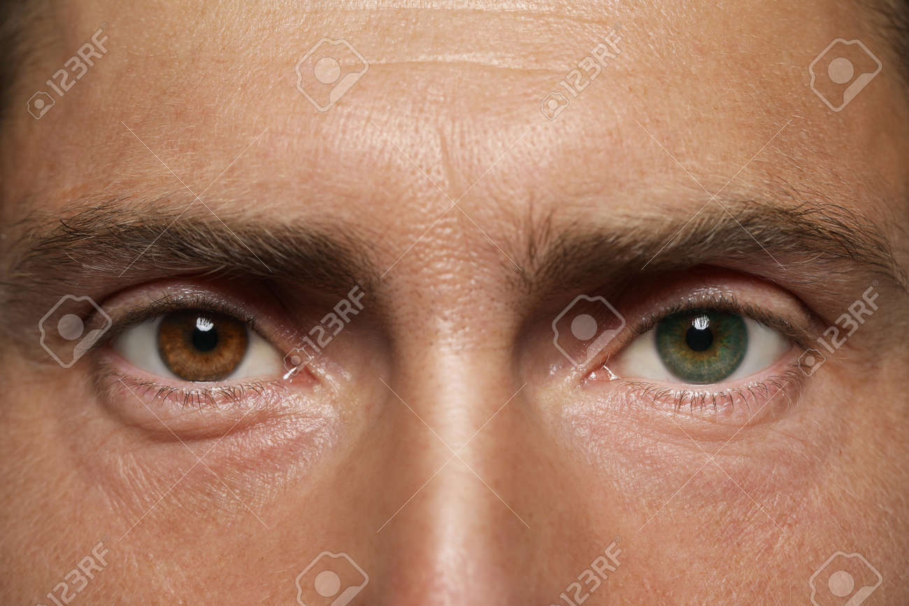 黒と白の本当虹彩異色症と美しい人間の目 — ストック写真 © tervolina88@mail.ru188754926