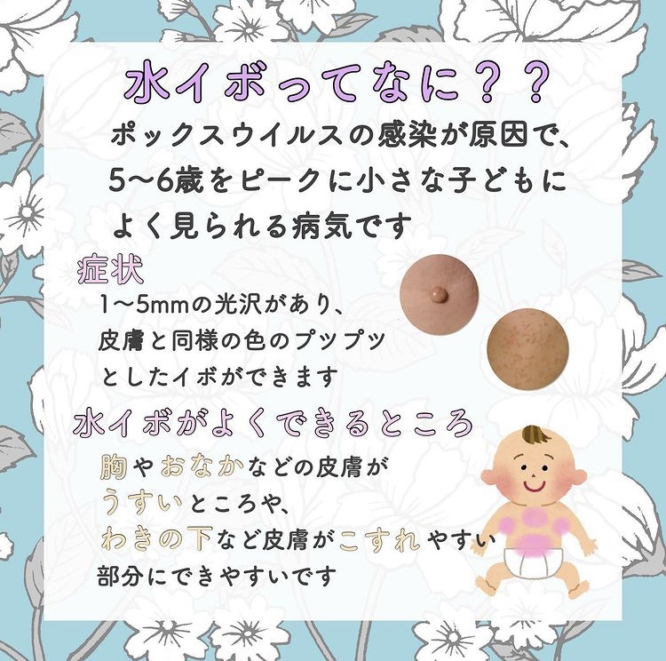 みずいぼの症状と原因、治療海老名皮フ科クリニック