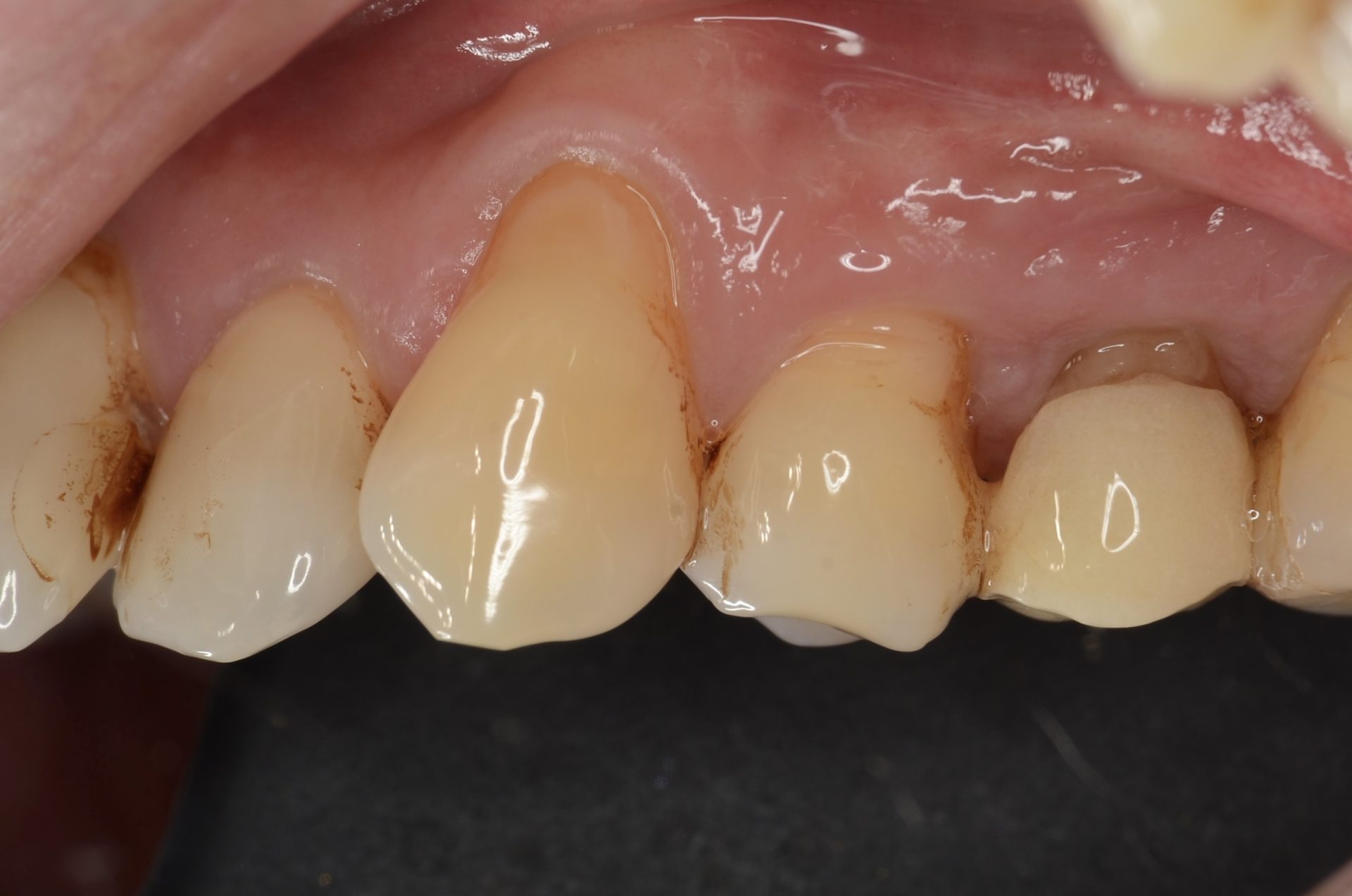 犬歯削られ 声帯も切られ｢柴犬｣「秋田犬」相次ぎ遺棄 メス犬に偏りか いったい誰が徳島 2023年6月15日掲載 日テレNEWS NNN