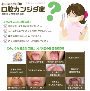 口腔カンジダ症の診かた，治療，予防