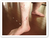 猫の寄生虫の症状は？ノミ、フィラリア、マンソンetc 寄生虫ごとに解説しますぽちたま薬局スタッフブログ