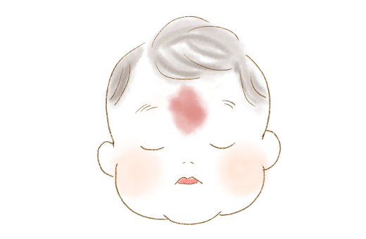 娘の顔に“生まれつきのアザ” ８ヵ月間の記録とママの願いに275万再生「素敵な言葉」「救われた」オリコンニュース ORICON NEWS