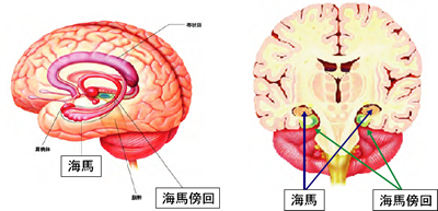 緑茶と記憶をつかさどる海馬の関連 認知症予防国立長寿医療研究センタ