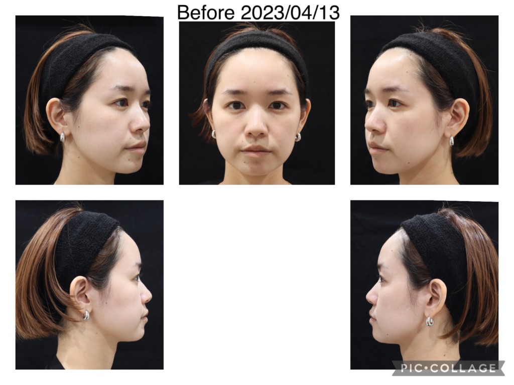 eクリニック新宿院のカウンセリングが初めての方へeクリニック新宿院 公式 美容整形・美容外科