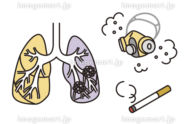 人工呼吸器のイラスト素材72531833- PIXTA