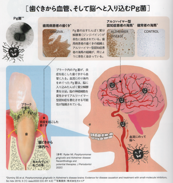 蜂窩織炎 急な腫れと熱があり、痛い！- 古東整形外科・リウマチ科