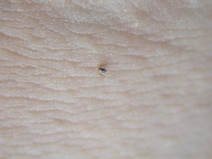 ご近所のマダニ - 旧｢いもむしうんちは雨の音｣置き場