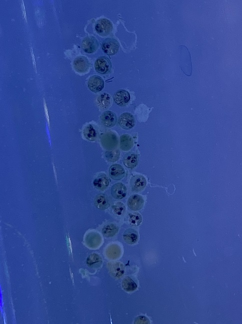 メダカの卵を孵化させるには水温と水質が重要！孵化しない卵の孵化率を上げる方法Salt＆Fresh 魚の総合サイト‐ソルフレ‐