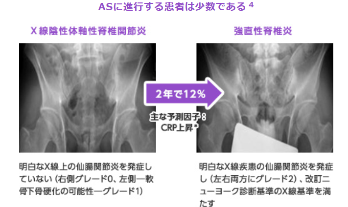 とうえいブログ大阪市東淀川区の 内科,リウマチ科 東永内科リウマチ科