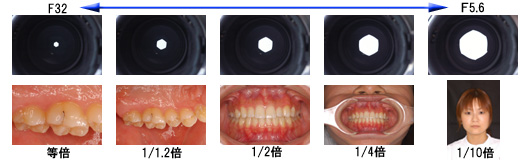 口腔内写真の撮影方法 39枚法の撮り方と4つのポイント