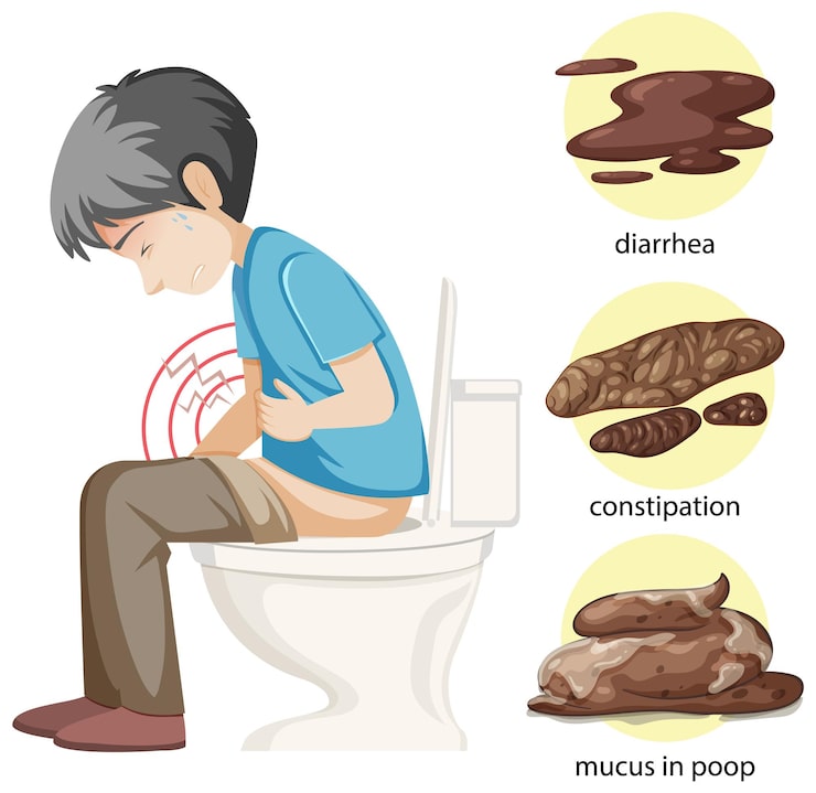 尿にタンパクがおりている 蛋白尿 原因・病気・何科。検査・治療神戸市東灘区の「いしむら腎泌尿器科クリニック」
