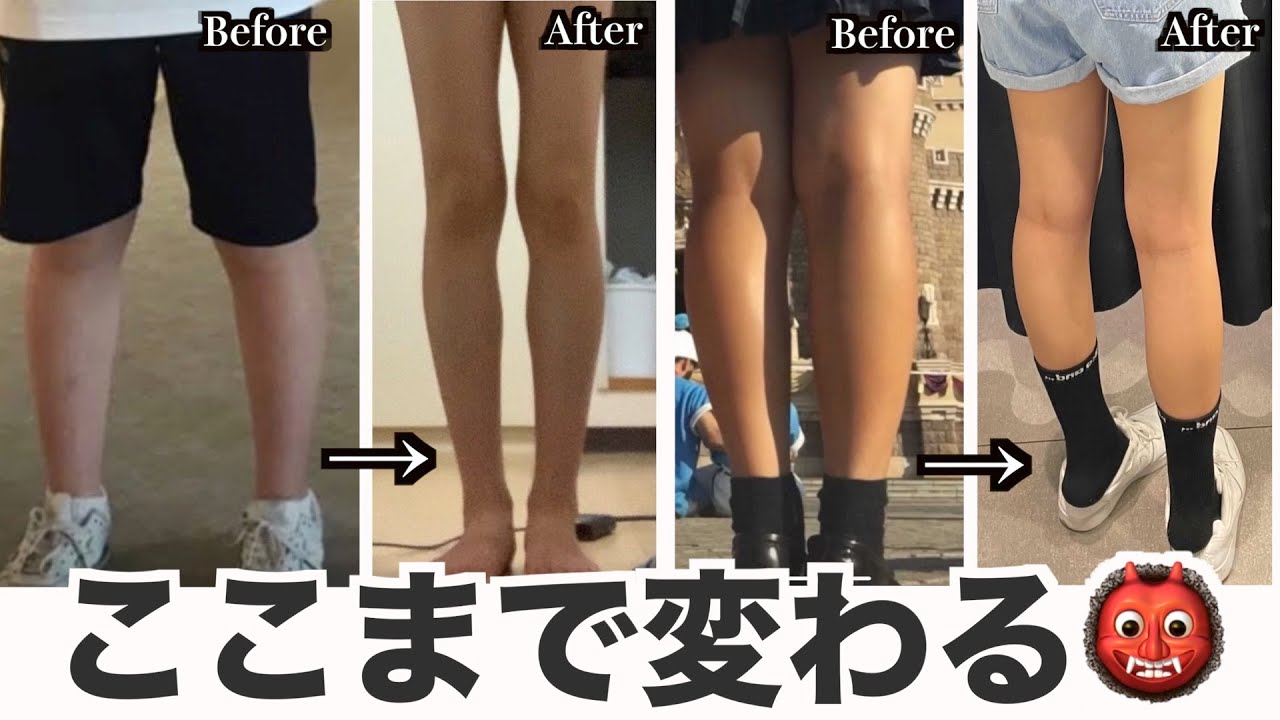写真公開 足パカのビフォーアフターはいつから？効果を出す正しいやり方と頻度を解説 - おすすめ co BEAUTY オススメシーオービューティー