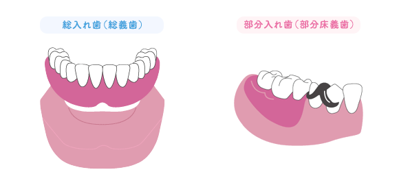 義歯・入れ歯アップル歯科尼崎駅前