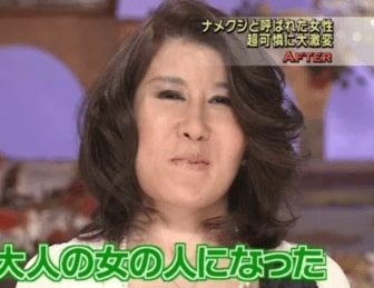 ビューティーコロシアムのその後！飛び降りや死亡で打ち切り？ 2024最新