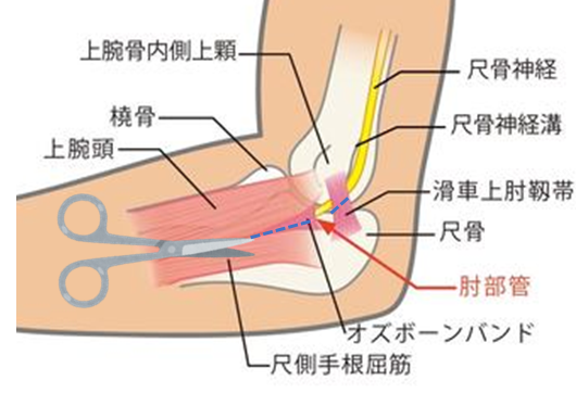 尺骨神経 しゃっこつしんけい、Ulnar Nerve- 都島整形外科クリニックブログ