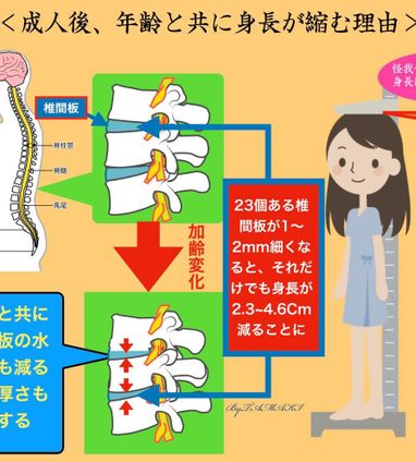 ご高齢者のお母さんが身長が縮んだことを話し始めたら伝えて欲しい予防法加古川市新神野 ひさき鍼灸整骨院