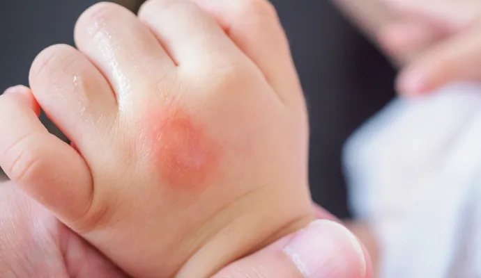 子どもの夜泣きや癇癪の原因とされる“疳の虫”を封じるおまじない 虫切り加持 富士川町・昌福寺山梨のニュースＵＴＹテレビ山梨1ページ