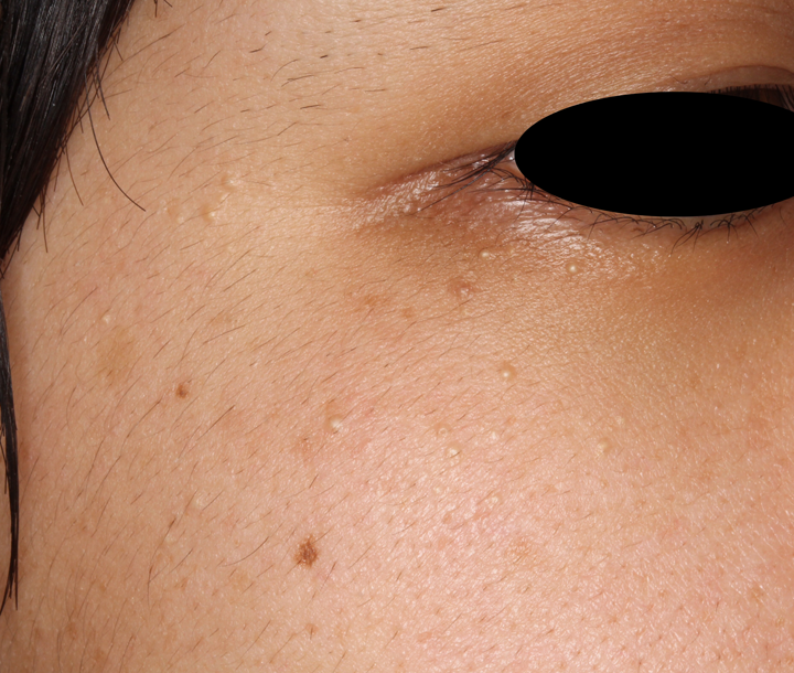 舌なめずり皮膚炎にも、ワセリン – もものマークのほけんしつ