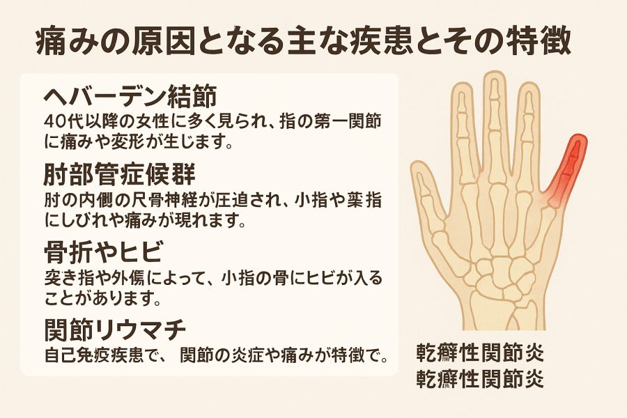 小指下の角質、要注意！, ここは反射区で言うと, 肩にあたります。, そして、角質ができる場合, その反射区が弱っている証拠,なので、ここの反射区に, 角質があるかたは, 肩こりが, 強い傾向にあります。, かたーくなっている場合, お風呂に入った後, 柔らかくなってから,ほぐすのがオススメ！, ぜひ、やってみてね！, 過去にこの投稿をみて, 実践してくださった方で, タコが無くなった！,